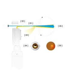 HEINE BETA 200S Ophthalmoskop