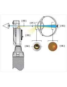 Ensemble Ophtalmoscope HEINE BETA 200 LED BETA 4 USB