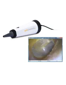 ORLvision USB Video Otoskop OX2