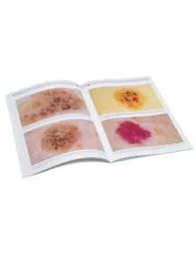 HEINE Compendium de dermoscopie