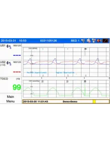 Moniteur fœtal avec surveillance des jumeaux Smart 3
