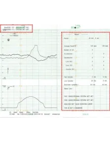 Moniteur fœtal avec surveillance des jumeaux Smart 3