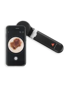 Dermatoscope HEINE DELTA 30 avec DermApp