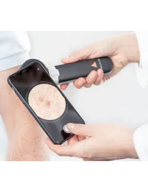 HEINE DELTA 30 Dermatoskop mit Charger 30 Tisch-Ladegerät