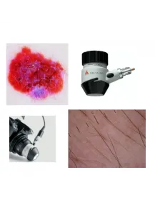 SLR Fotoadapter-Set für DELTA 20 Dermatoskop