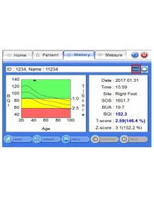 Ultraschall Knochendichte-Messgerät Inus S mit integriertem PC