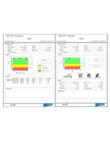 Appareil de mesure de la densité osseuse par ultrasons Inus S avec PC intégré
